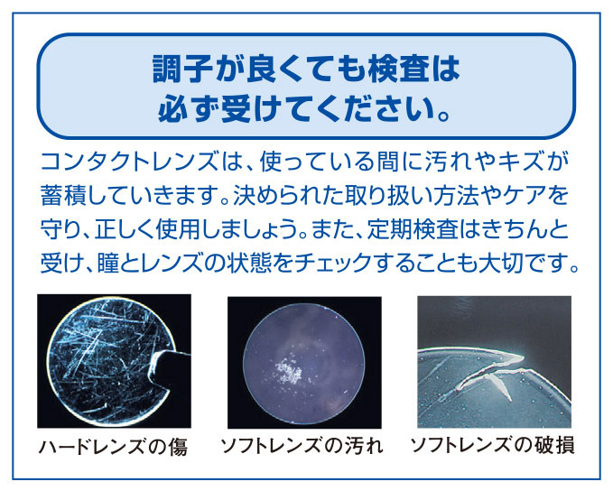 コンタクトレンズをご希望の方へ